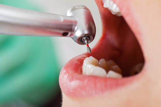 Best Emergency Wisdom Teeth Removal in , RI